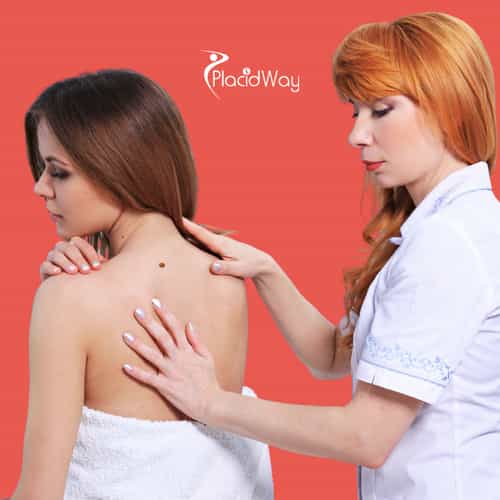 Tratamiento del melanoma en México: Explorando el papel de las terapias inmunológicas y alternativas para obtener mejores resultados 